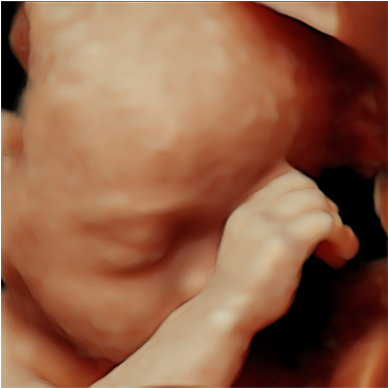 Reveal Hidden Details And Enrich Clinician-patient - Baby - Transparent PNG Free Download