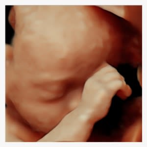 Reveal Hidden Details And Enrich Clinician-patient - Baby - Transparent PNG Free Download