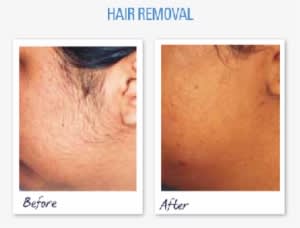 But The Good News Is, Technology Has Come A Long Way - Scar - Transparent PNG Free Download