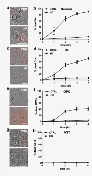 Human Complement Is Toxic To Mouse Neurons And Oligodendrocytes - Transparent PNG Free Download