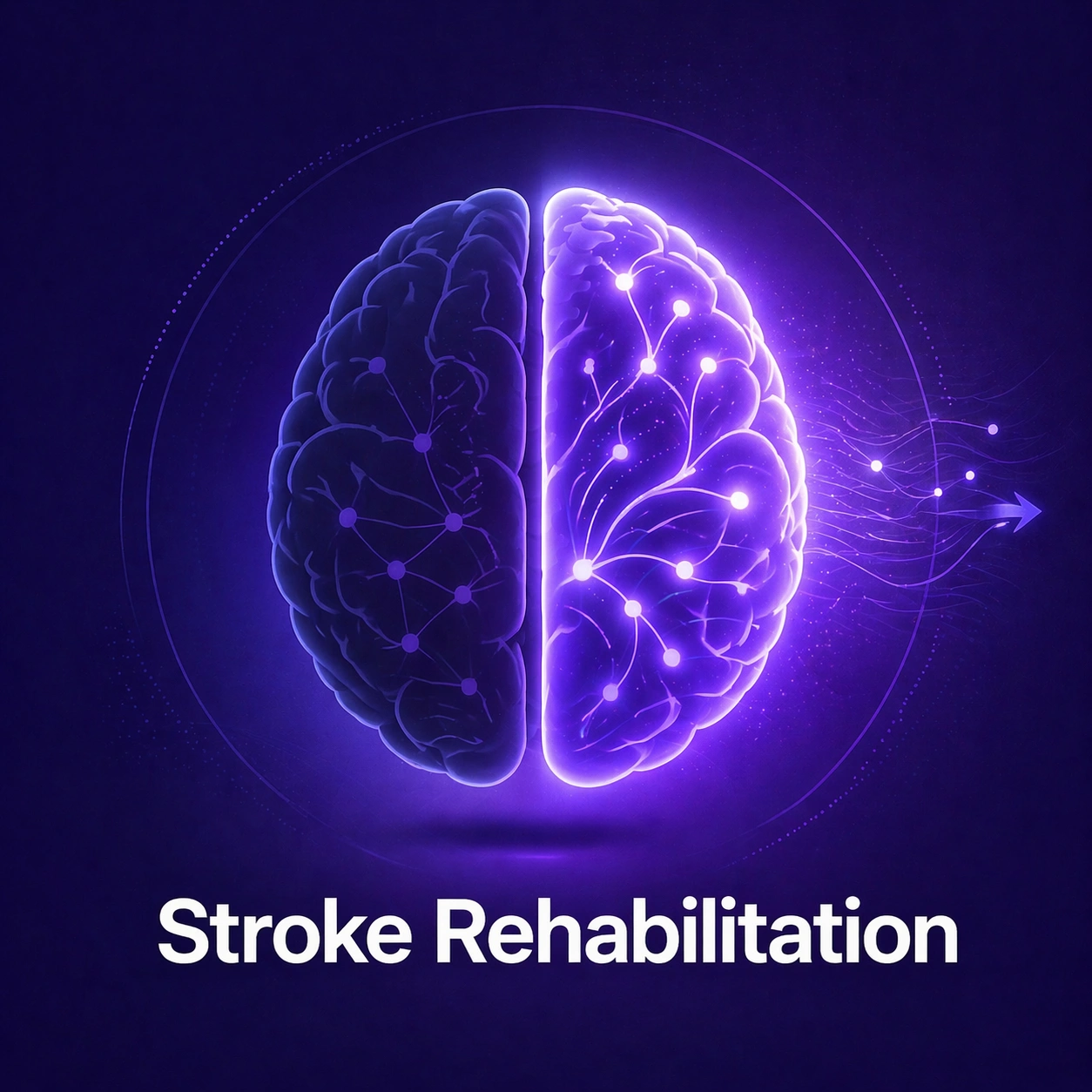 Stroke Rehabilitation