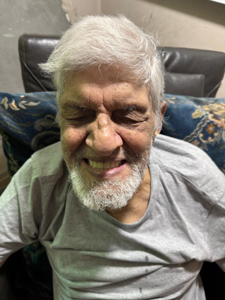 Satisfied patient with custom-fabricated denture restoring smile, comfort, and masticatory function. - Performed at DR. ZEE & Associates