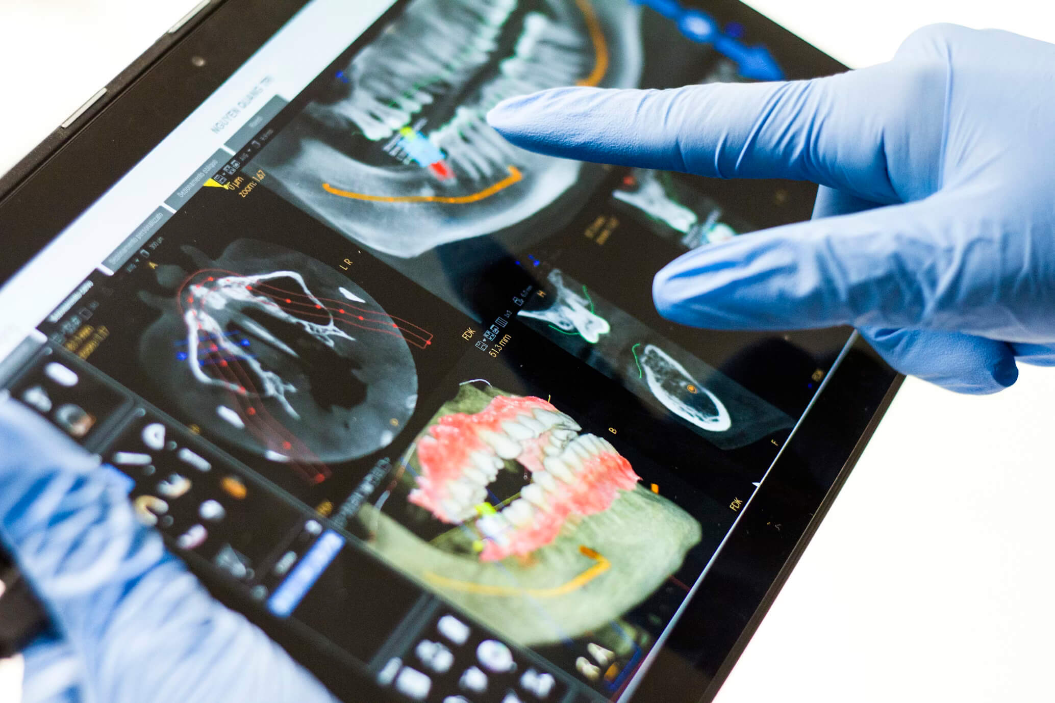 Expert RCT & Dental Implants in Lahore at Dr Saud Dental Surgery Lahore