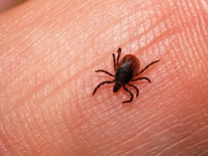 В ЯРОСЛАВСКОЙ БОЛЬНИЦЕ РАССКАЗАЛИ О ПЕРВОМ ЭНЦЕФАЛИТНОМ КЛЕЩЕ