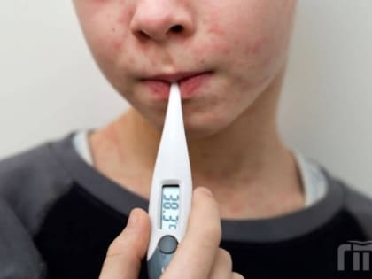 В Ростовском районе - вспышка кори