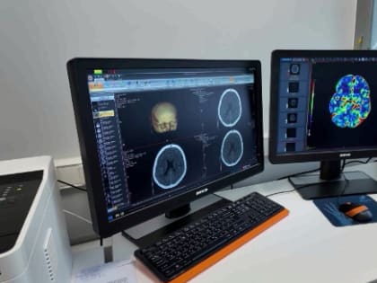 Новым компьютерный томограф из Угличской ЦРБ помог женщине вернуться к полноценной жизни