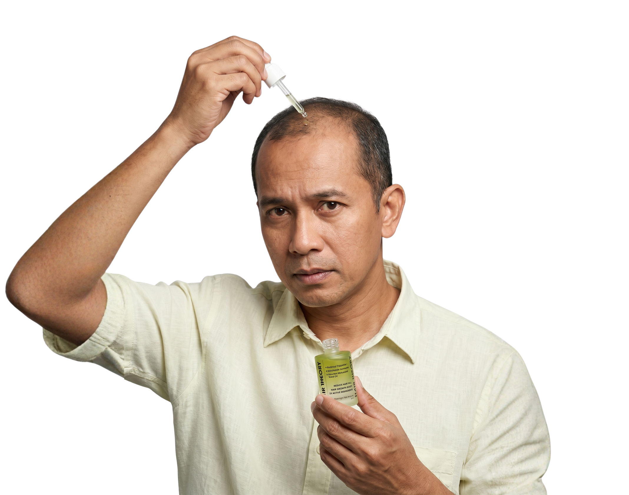 Hair Loss Model