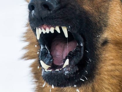 В Прикамье семье школьницы выплатят компенсацию за нападение собаки