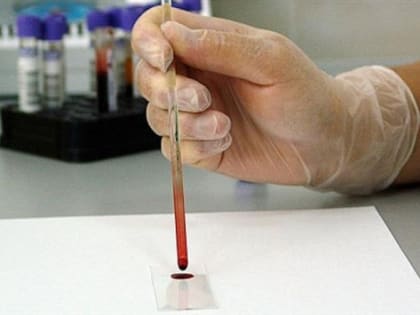 В Прикамье приезжают больные ВИЧ гастарбайтеры