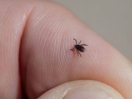 Около 800 человек пострадали от клещей за неделю в Алтайском крае