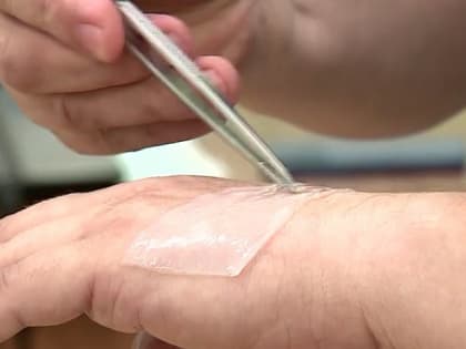 Учёные Алтайского медуниверситета научились заживлять раны и язвы с помощью «чайного гриба»