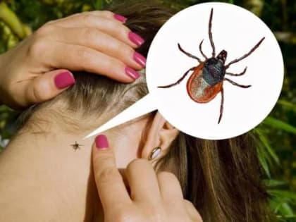 783 жителя Алтайского края пострадали от присасывания клещей за неделю