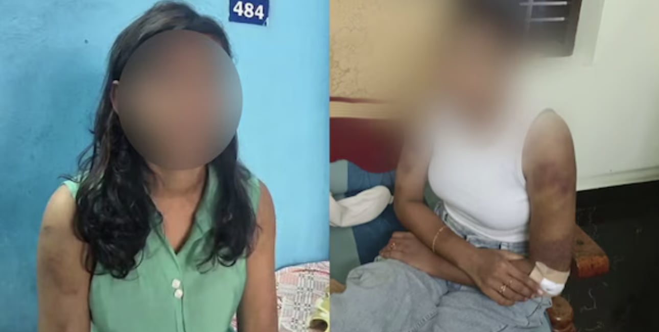 സ്ത്രീധനത്തിന്റെ പേരിൽ വീണ്ടും ക്രൂരത; കേരള മനഃസാക്ഷിയെ ഞെട്ടിച്ച് മറ്റൊരു പീഡനവാർത്ത കൂടി പുറത്ത്