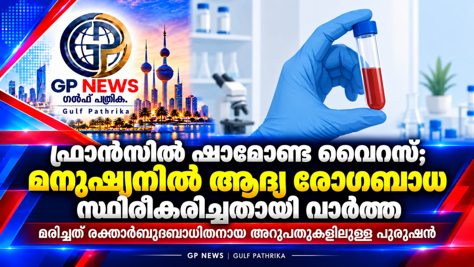 ഫ്രാൻസിൽ ഷാമോണ്ട വൈറസ് മനുഷ്യനിൽ സ്ഥിരീകരിച്ചതായി വാർത്ത; മരിച്ചത് രക്താർബുദബാധിതനായ അറുപതുകളിലുള്ള പുരുഷൻ
