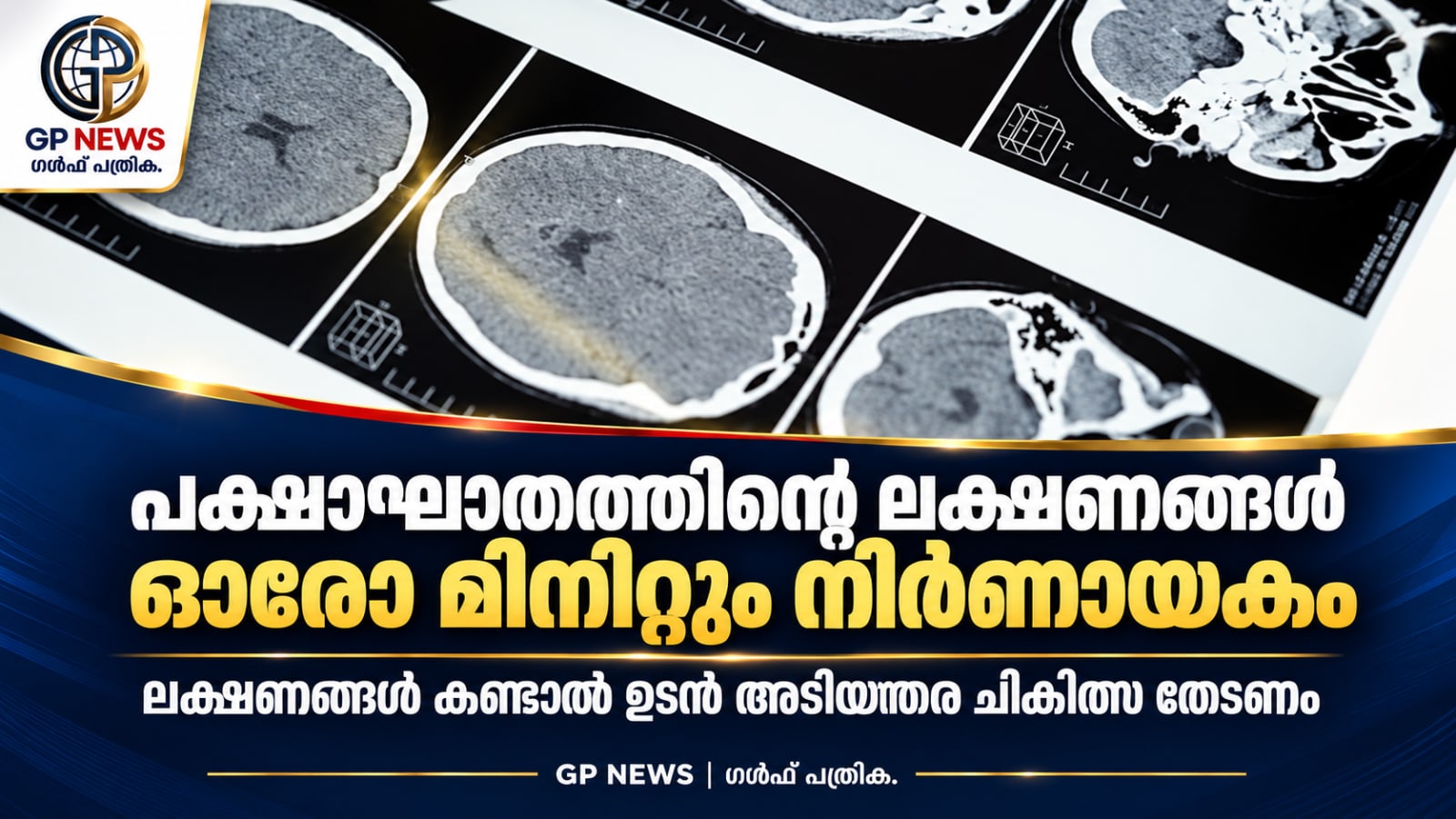 പക്ഷാഘാതത്തിന്റെ ലക്ഷണങ്ങൾ തിരിച്ചറിയണം; ചികിത്സയിലെ ഓരോ മിനിറ്റും നിർണായകം