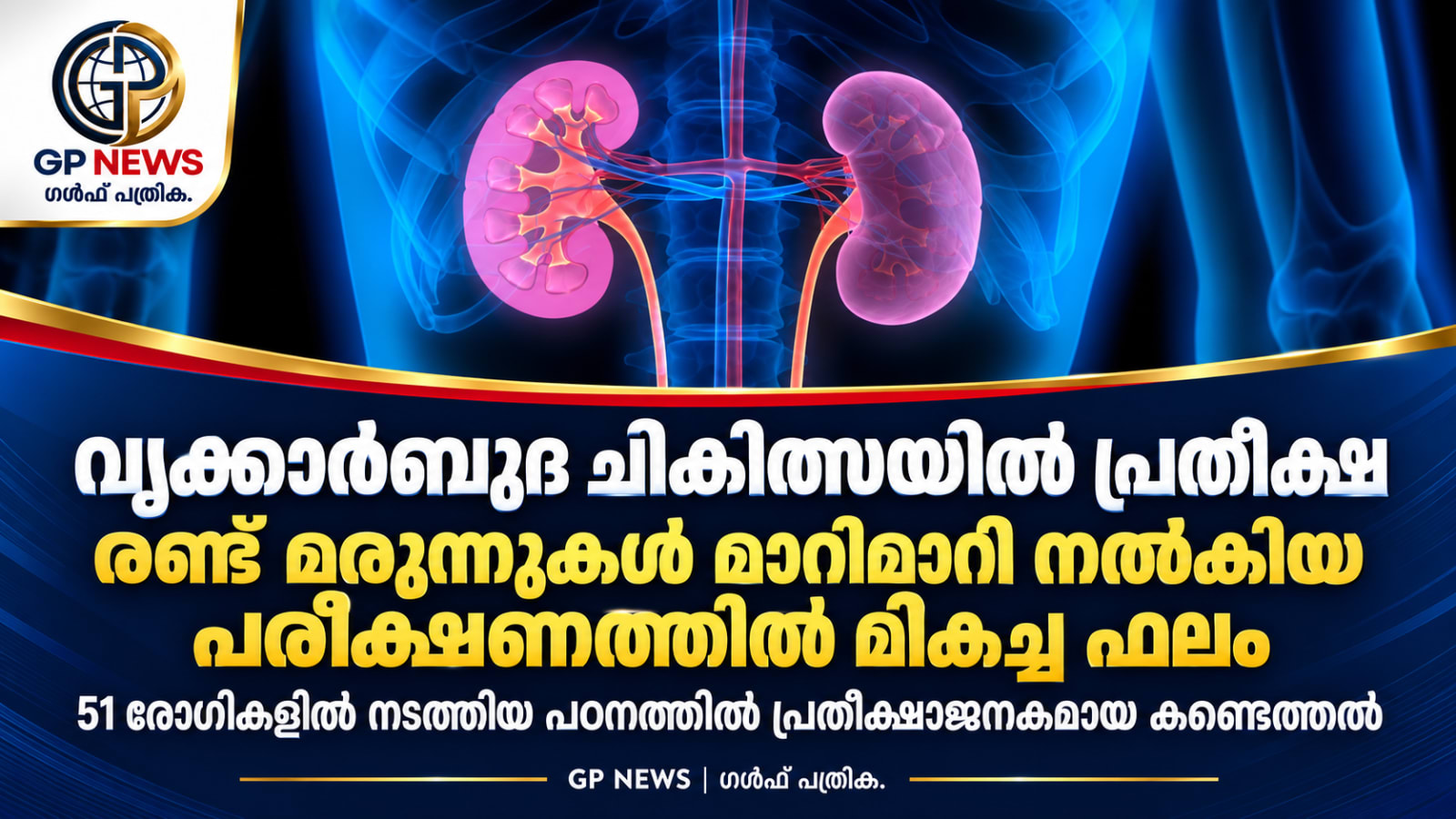 വൃക്കാർബുദ ചികിത്സയിൽ പ്രതീക്ഷ; രണ്ട് മരുന്നുകൾ മാറിമാറി നൽകിയ പരീക്ഷണത്തിൽ മികച്ച ഫലം
