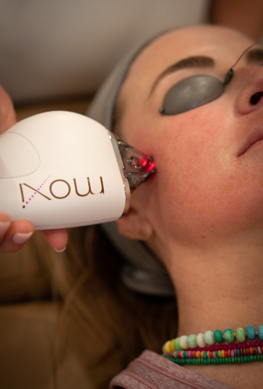 Moxi Laser