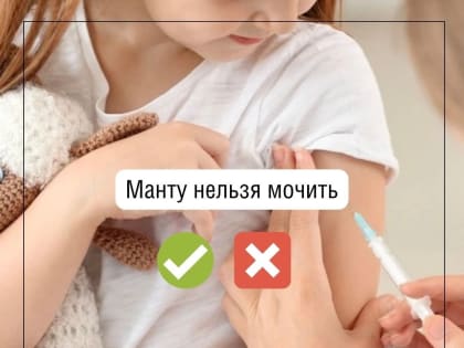 Развеиваем мифы. Манту нельзя/можно мочить?