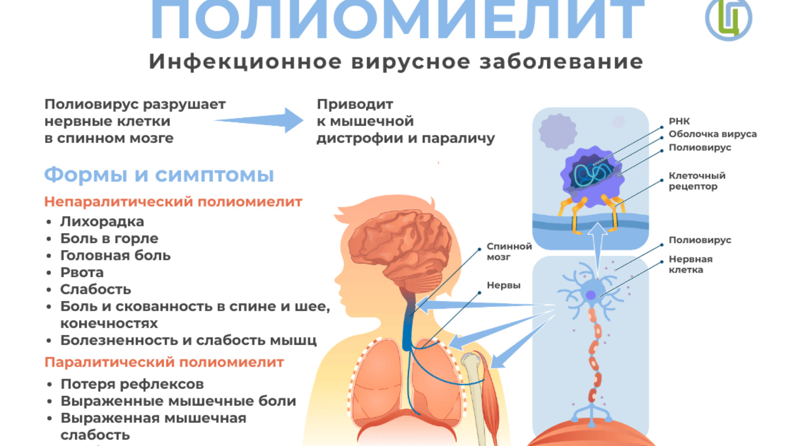 Полиомиелит презентация педиатрия