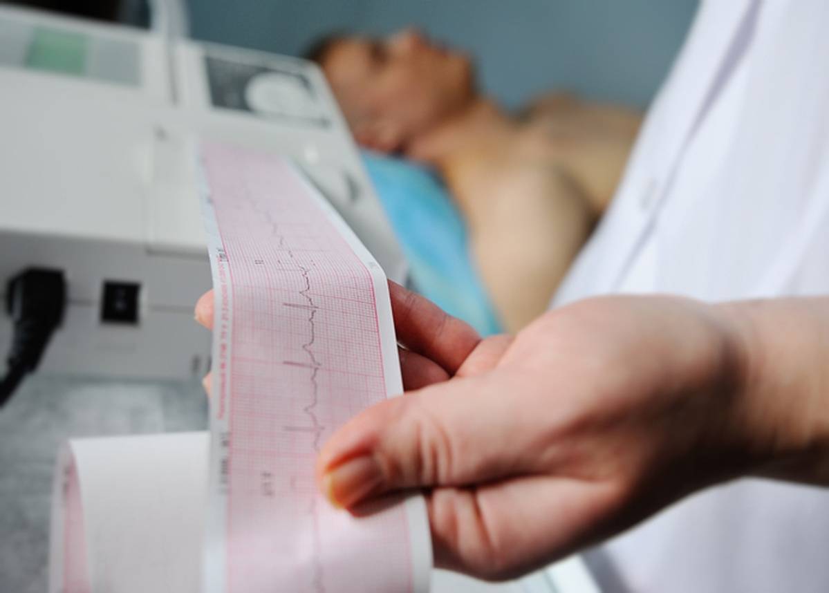 Electrocardiogram (ECG) at UMANG Hospital