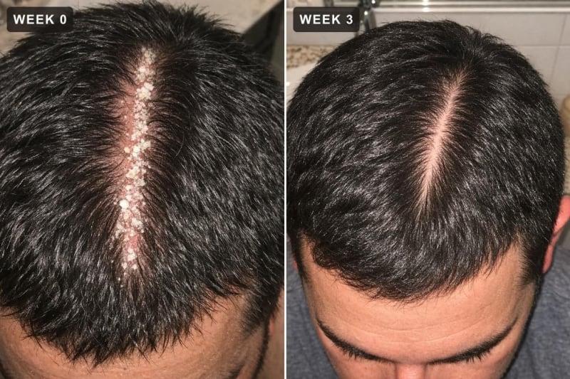 Part line, week 0 and week 3
