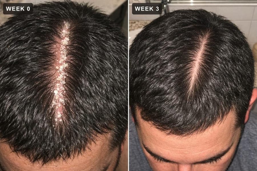 Part line week 0 and week 3: same density, no flakes