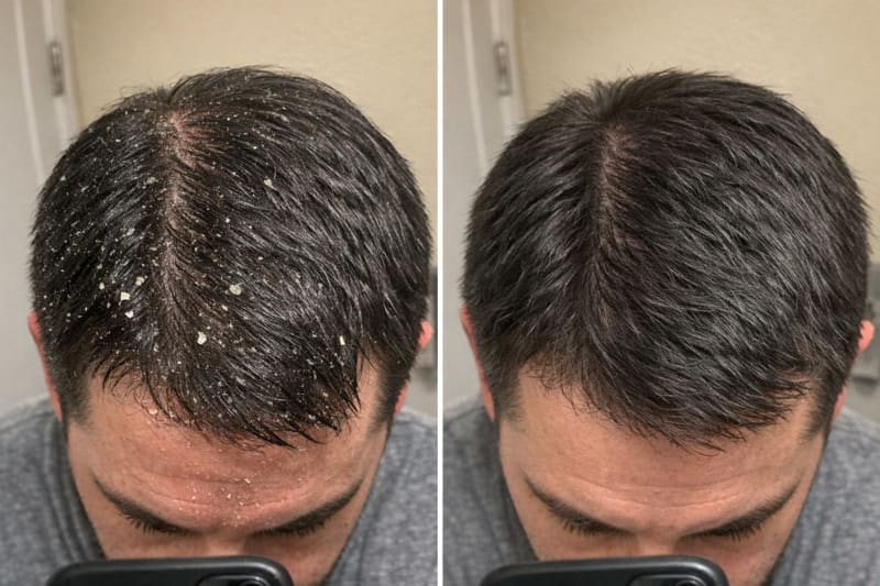 The crown from above, week 0 and week 4