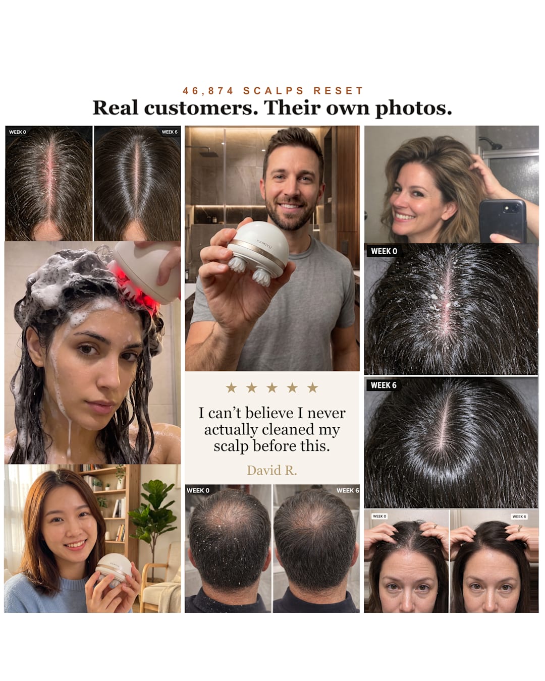 46,874 scalps reset: real customer photos
