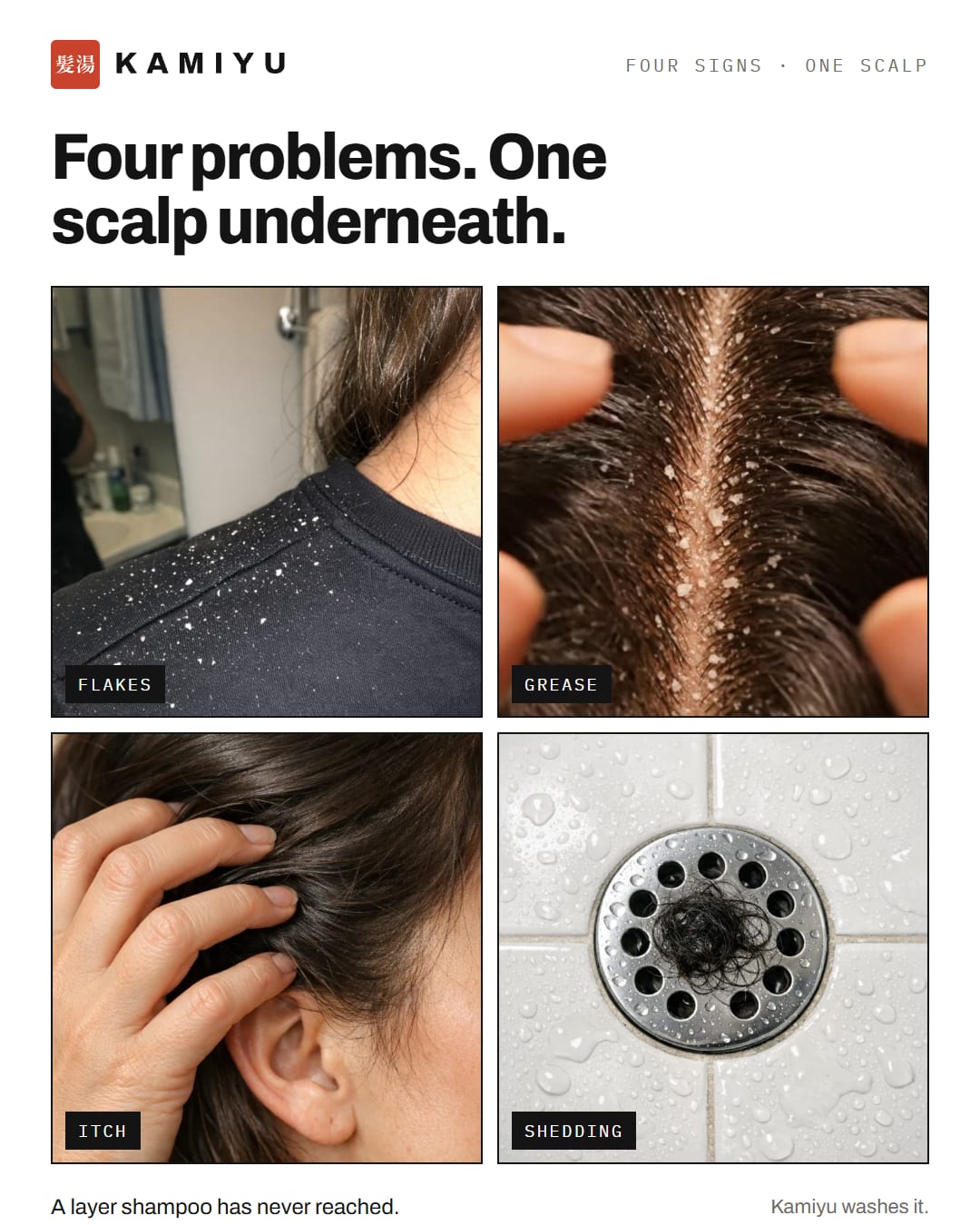 Four problems, one scalp: flakes, grease, itch, shedding