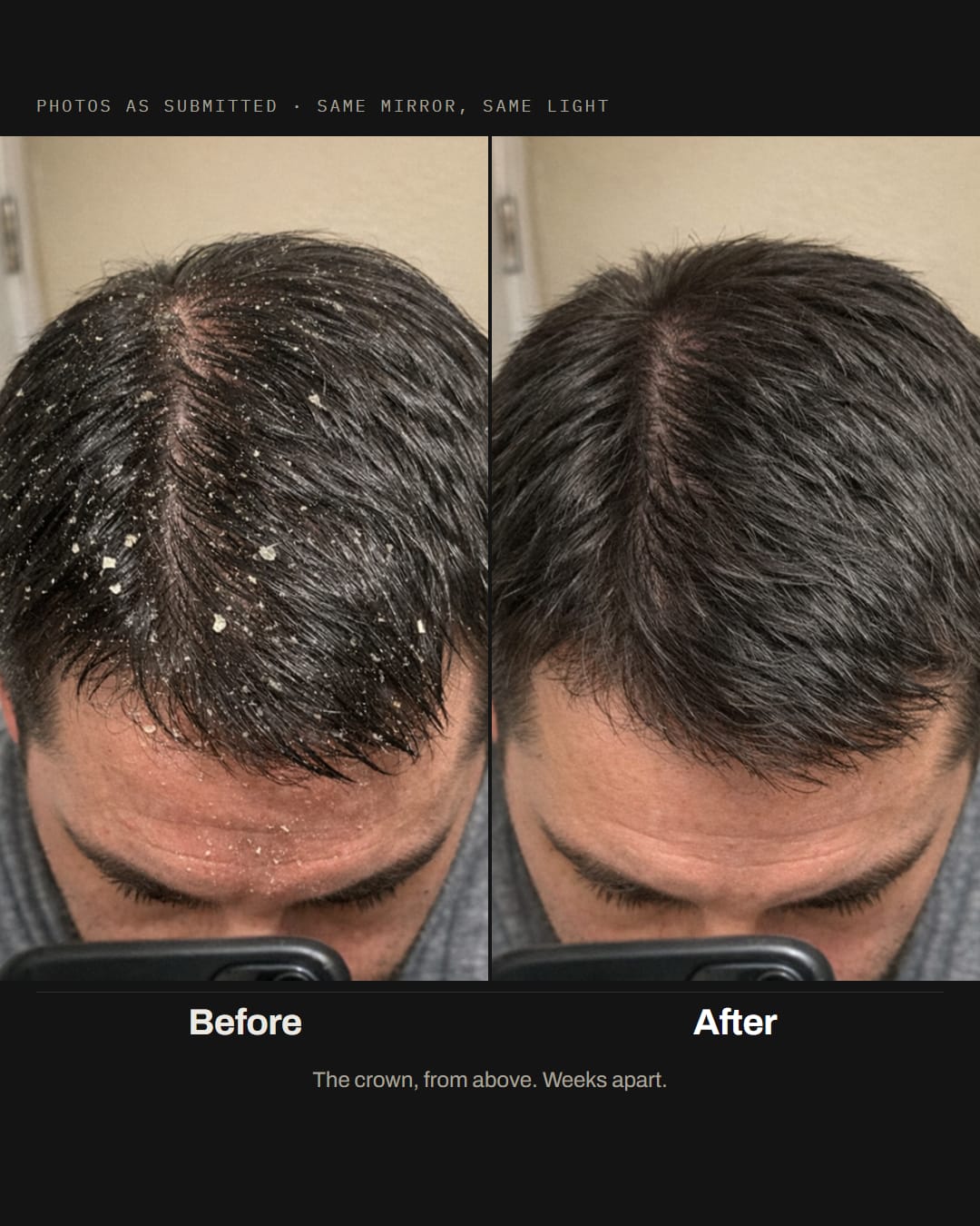 Before and after, same bathroom: flakes and grease along the crown on the left, the same crown clean on the right
