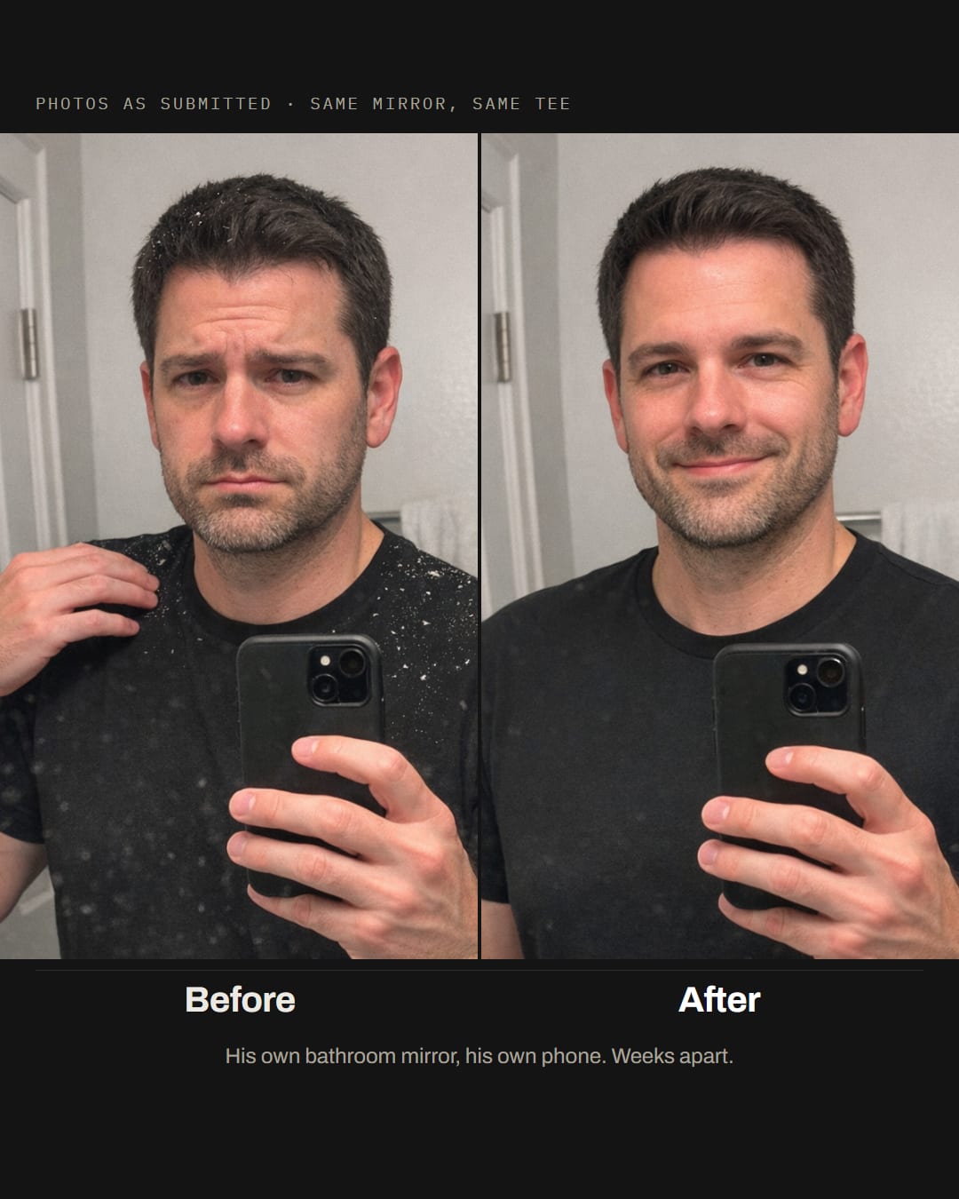 Before and after, his own mirror: flakes across the black t-shirt shoulders on the left, the same shirt clean on the right