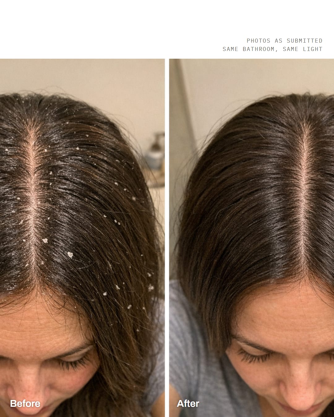 Before and after, her own bathroom mirror: greasy roots and flakes along the part on the left, the same part clean on the right