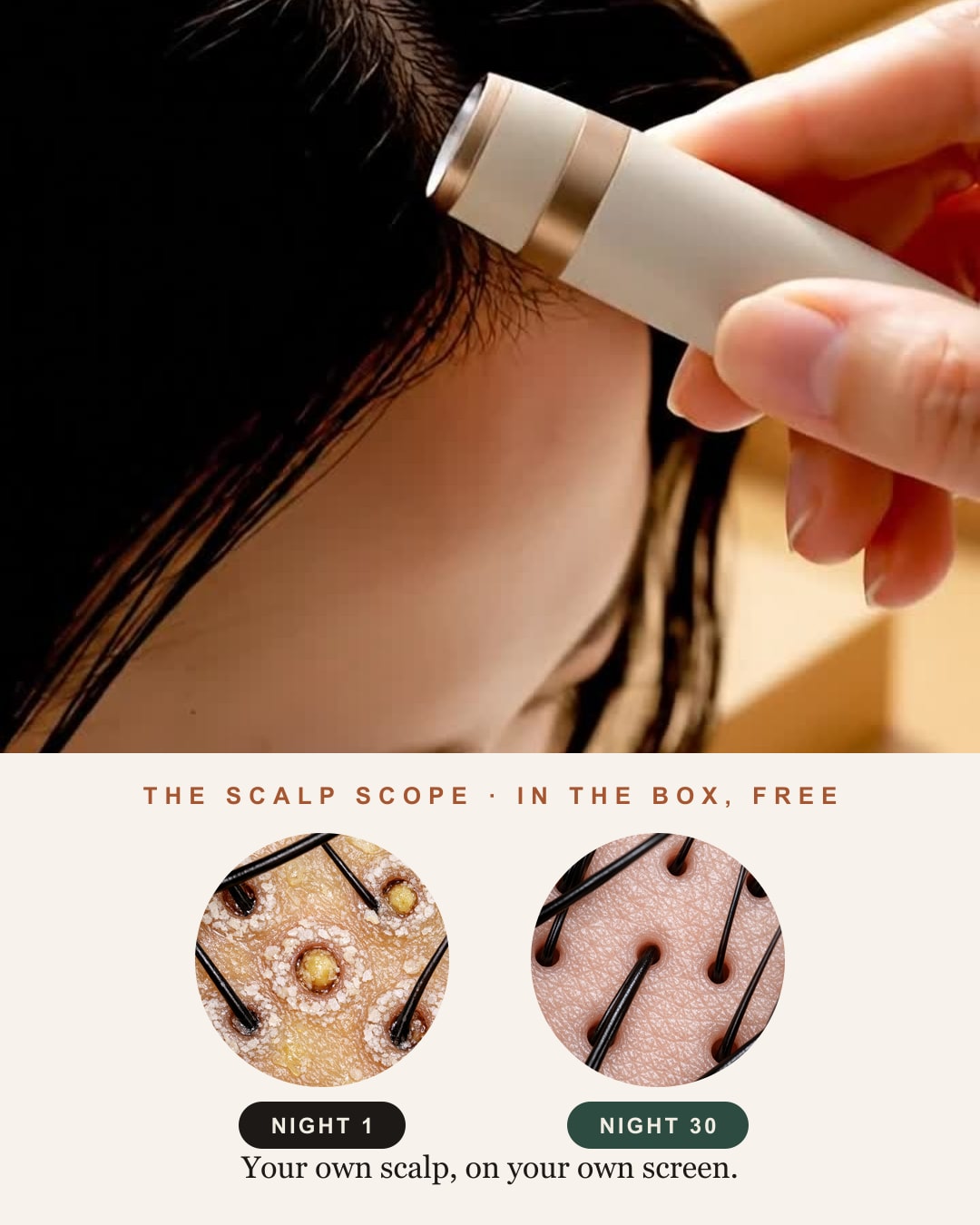The Scalp Scope in use, and what it shows: night 1 vs night 30