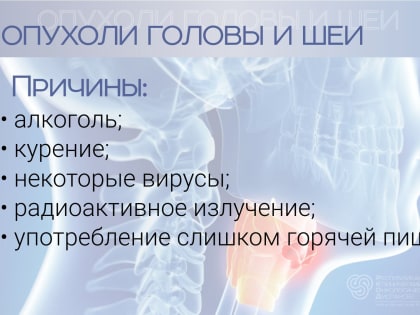 Опухоли головы и шеи