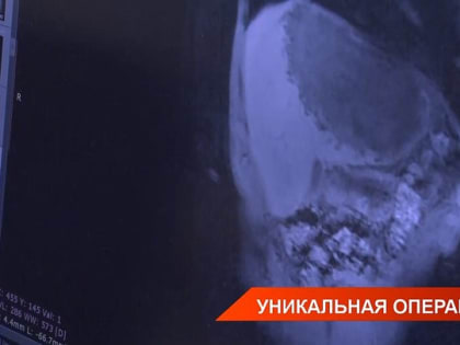 В Татарстане врачи очистили печень пациента от паразитов — видео