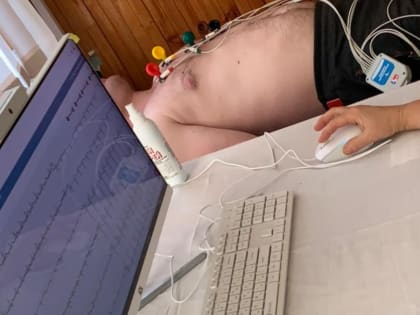 Установка аппарата ЭКГ