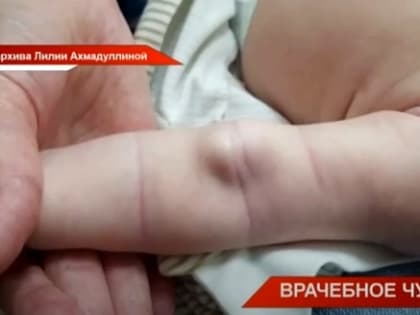 Стало известно, в чем уникальность операции врачей ДРКБ, попавшей в Книгу рекордов РФ