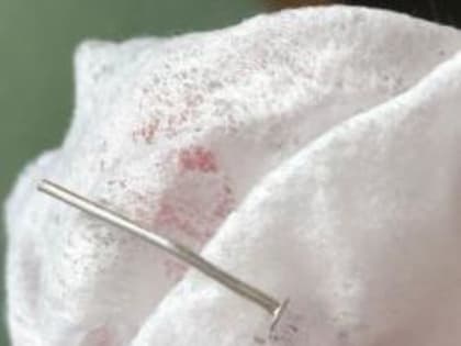 В Башкирии годовалая девочка проглотила гвозди