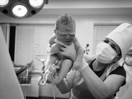 Женщины боятся родов, поэтому хотят кесарево сечение, а зря