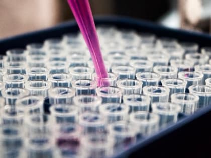 Специалисты Роспотребнадзора не обнаружили возбудителей холеры в водоемах Удмуртии