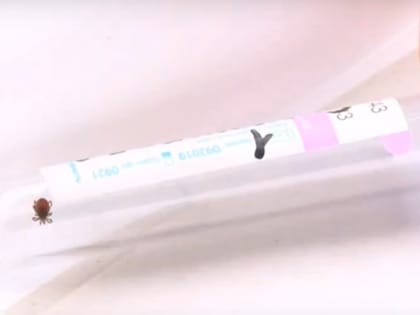 Почти 10 тысяч жителей Удмуртии укусили клещи