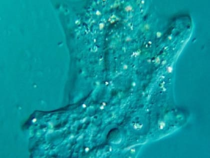 В Индии амеба проникла в мозг подростка и убила его