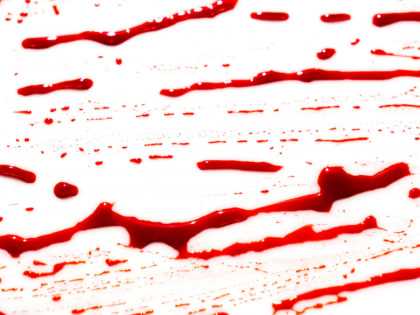 В Ижевске шизофреник с ножом напал на бригаду врачей