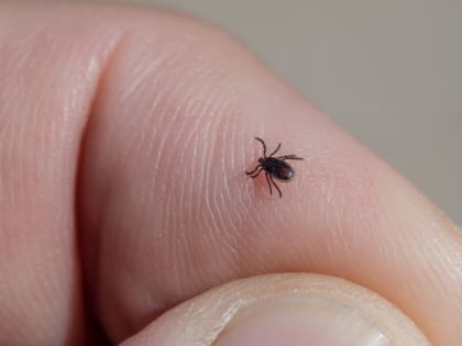 Первые случаи присасывания клещей зарегистрировали в Удмуртии