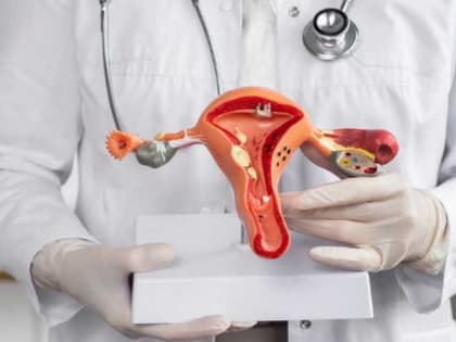 Пилотный проект по скринингу рака шейки матки в Хакасии: итоги и перспективы