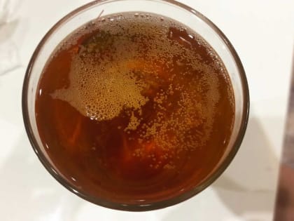 Врачи рассказали, что повышает риск невынашивания ребенка