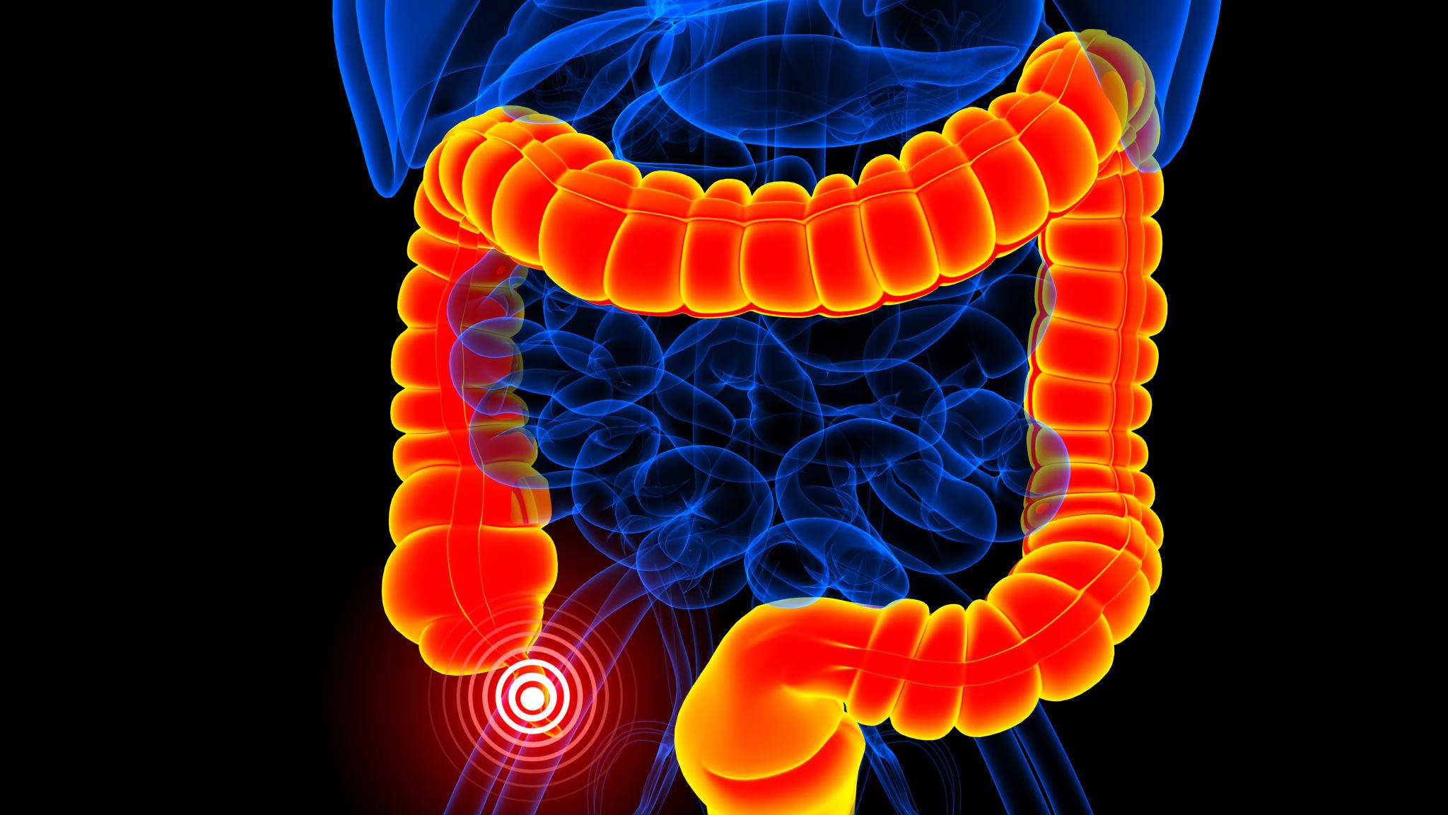 The Primary Location: Where Is the Appendix?