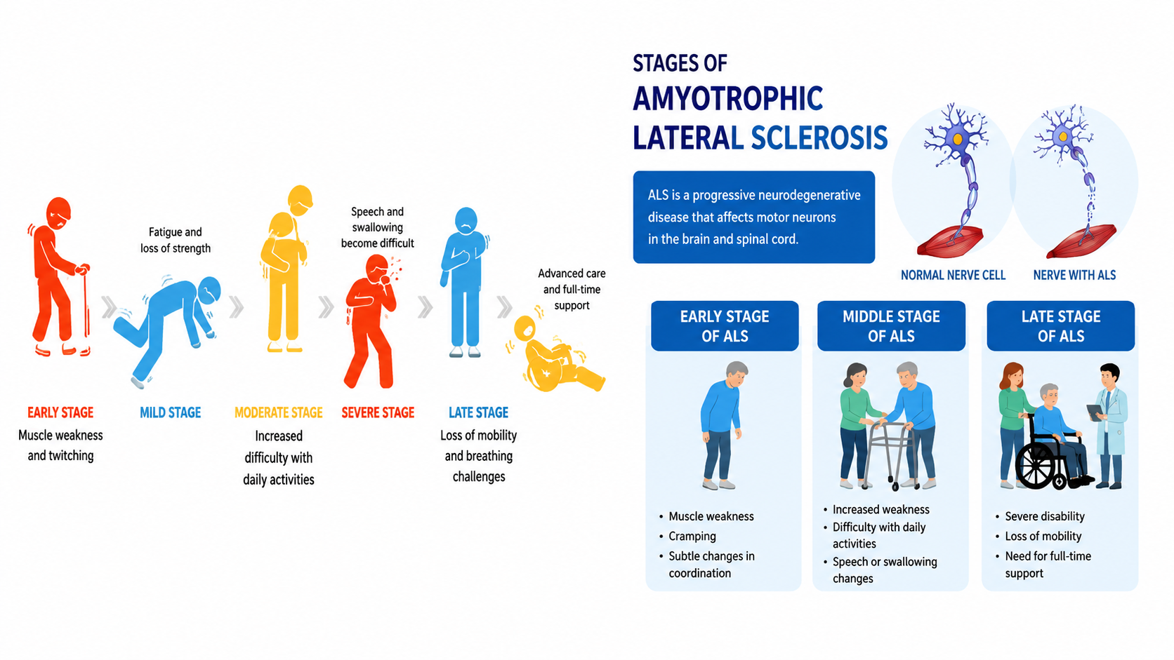 ALS Disease: A Comprehensive Guide to Understanding Symptoms, Diagnosis ...
