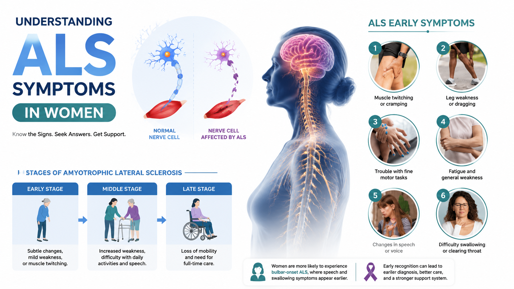 ALS Symptoms in Women: Understanding Early Signs and Gender-Specific ...