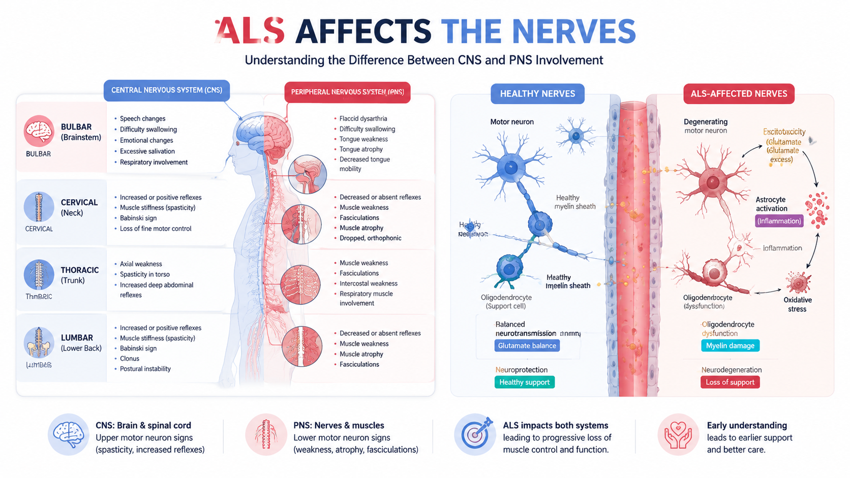 ALS Symptoms in Women: Understanding Early Signs and Gender-Specific ...